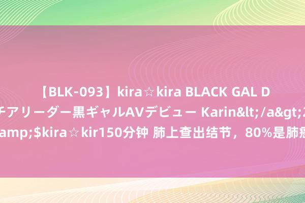 【BLK-093】kira☆kira BLACK GAL DEBUT 元・有名球団チアリーダー黒ギャルAVデビュー Karin</a>2013-04-19kira☆kira&$kira☆kir150分钟 肺上查出结节，80%是肺癌？大夫：不一定，需笔据骨子情况来看！